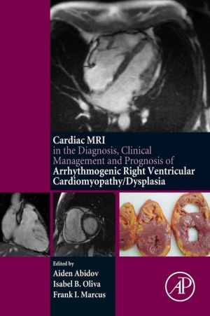 Cardiac MRI in Diagnosis, Clinical Management and Prognosis of Arrhythmogenic Right Ventricular Dysplasia/Cardiomyopathy