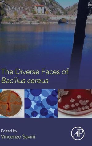 The Diverse Faces of Bacillus Cereus