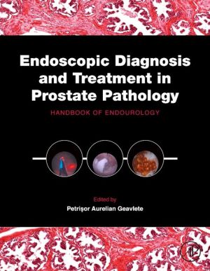 Endoscopic Diagnosis and Treatment in Prostate Pathology: Handbook of Endourology