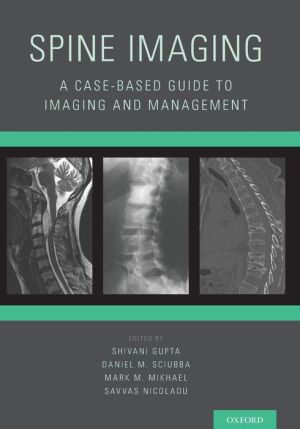 Spine Imaging: A Case-Based Guide to Imaging and Management