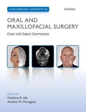 Challenging Concepts in Oral and Maxillofacial Surgery: Cases with Expert Commentary