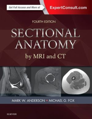 Sectional Anatomy by MRI and CT