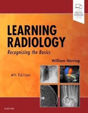 Learning Radiology: Recognizing the Basics|Paperback