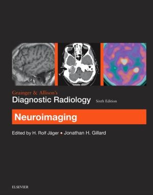 Grainger & Allison's Diagnostic Radiology: Neuroimaging