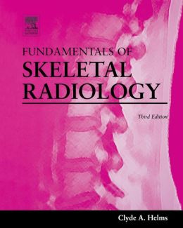 Fundamentals Of Skeletal Radiology Clyde A. Helms Free