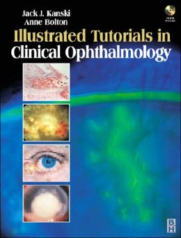 Illustrated Tutorials in Clinical Ophthalmology with CD-ROM