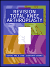 Revision Total Knee Arthroplasty