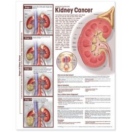 Understanding Kidney Cancer Anatomical Chart