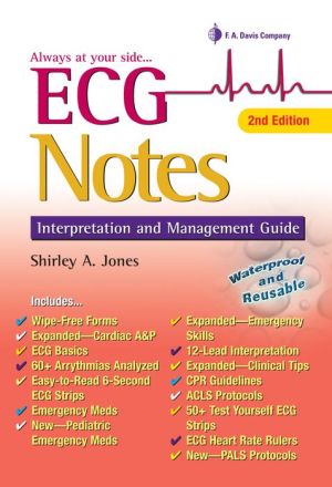 ECG Notes: Interpretation and Management Guide / Edition 2