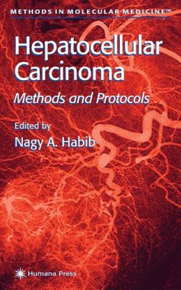 Hepatocellular Carcinoma. Methods and Protocols Nagy A. Habib