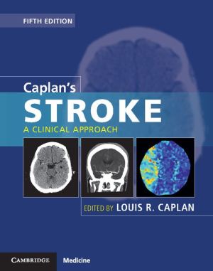 Caplan's Stroke: A Clinical Approach