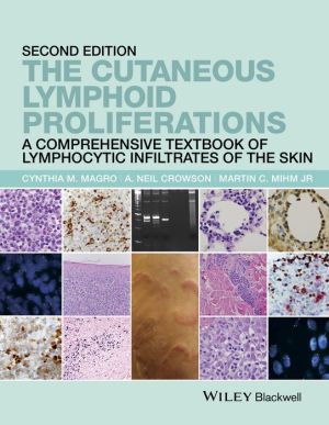 The Cutaneous Lymphoid Proliferations: A Comprehensive Textbook of Lymphocytic Infiltrates of the Skin / Edition 2