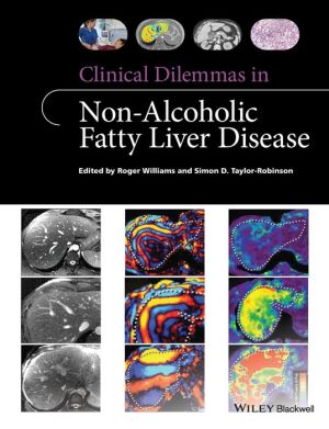 Clinical Dilemmas in Non-Alcoholic Fatty Liver Disease