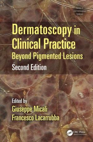 Dermatoscopy in Clinical Practice, Second Edition: Beyond Pigmented Lesions