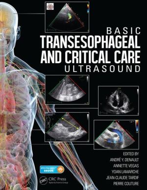 Basic Transesophageal and Critical Care Ultrasonography