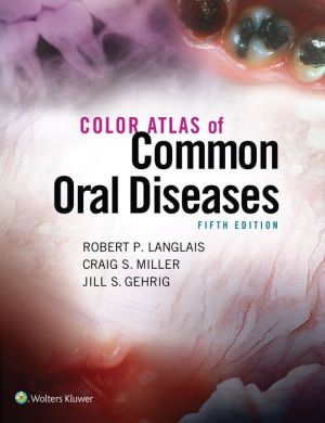 Color Atlas of Common Oral Diseases / Edition 5