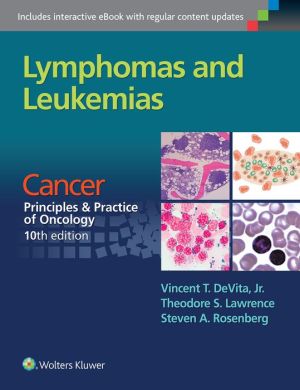 Lymphomas and Leukemias: A Derivative of Cancer: Principles & Practice of Oncology