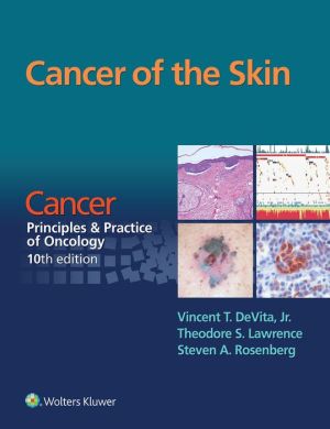 Cancer of the Skin: From Cancer: Principles & Practice of Oncology
