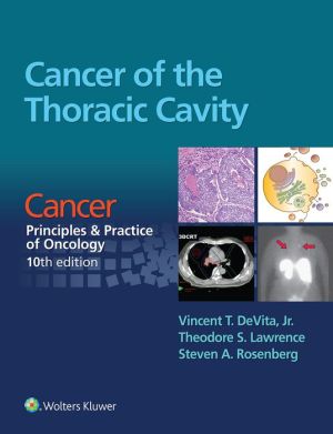 Cancer of the Thoracic Cavity: From Cancer: Principles & Practice of Oncology