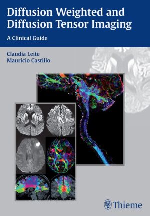 Diffusion Weighted and Diffusion Tensor Imaging: A Clinical Guide: A Clinical Guide