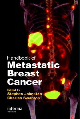 Handbook of Metastatic Breast Cancer Stephen Johnston and Charles Swanton