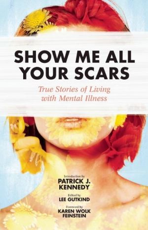 Show Me Your Scars: True Stories of Living with Mental Illness
