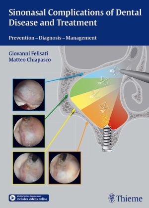 Sinonasal Complications of Dental Disease and Treatment: Prevention - Diagnosis - Management