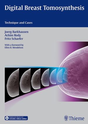 Digital Breast Tomosynthesis: Technique and Cases