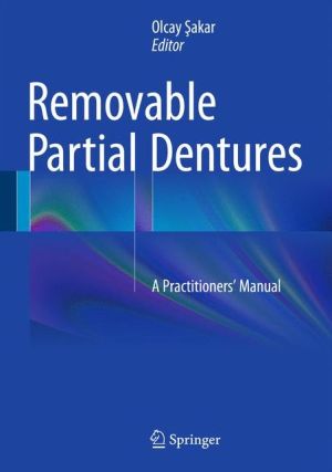 Removable Partial Dentures: A Practitioners' Manual