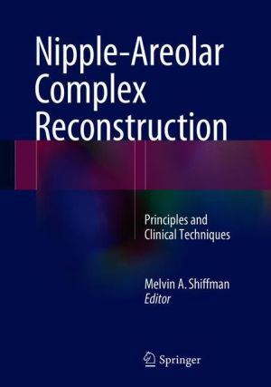 Nipple-Areolar Complex Reconstruction: Principles and Clinical Techniques